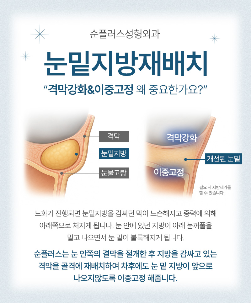 눈밑지방재배치 주의사항 체크와 회복기간 까지 관련 이미지 3