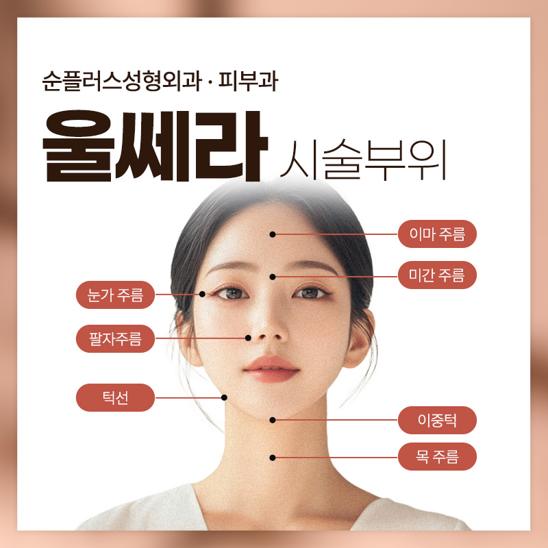 At a place that does Ulthera well: using genuine tips and the recommended shot count according to skin condition, such as 300, 400, and 500 shots image 5