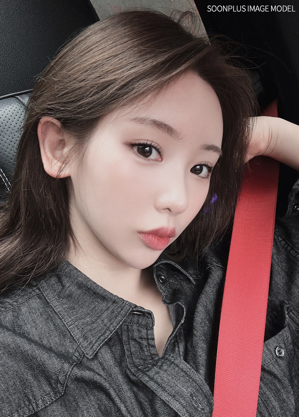 눈밑지방재배치잘하는병원 추후 재발예방하고 관련 이미지 1