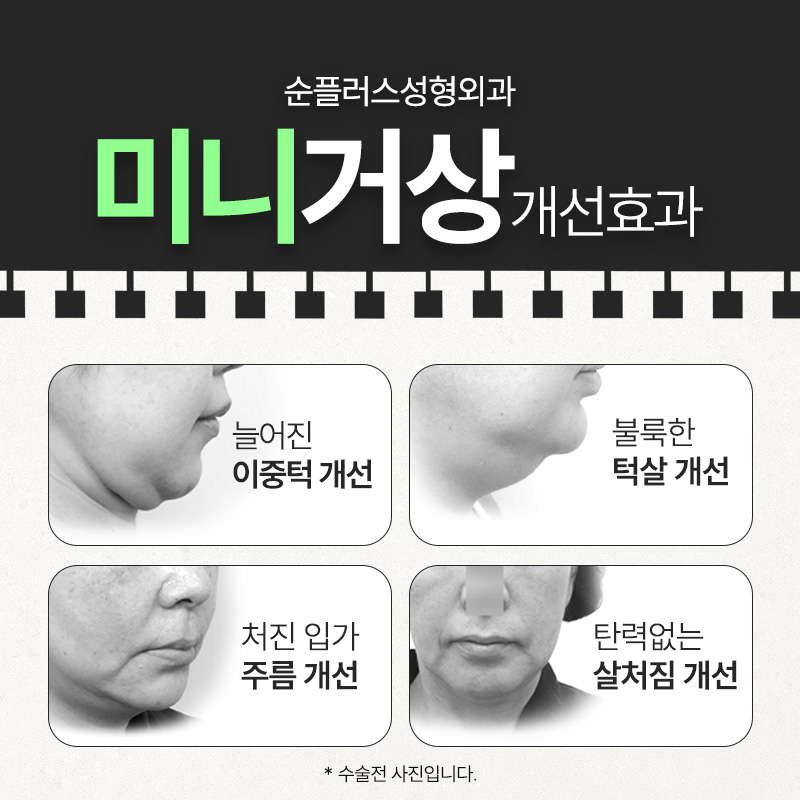 미니거상 추천대상부터 가격 후기 까지 관련 이미지 4