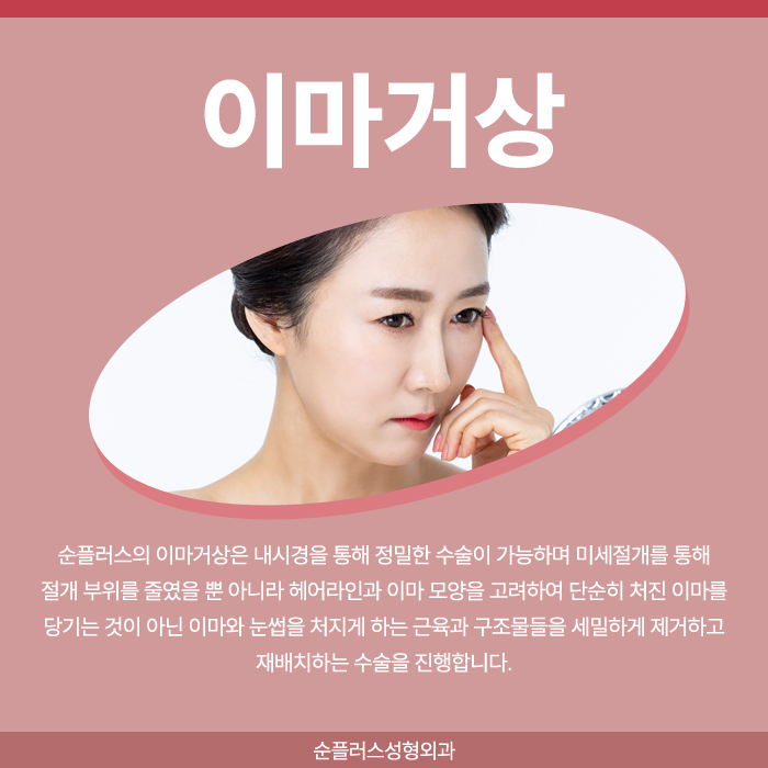 이마주름수술 자연스러운 개선방안을 위해 관련 이미지 2