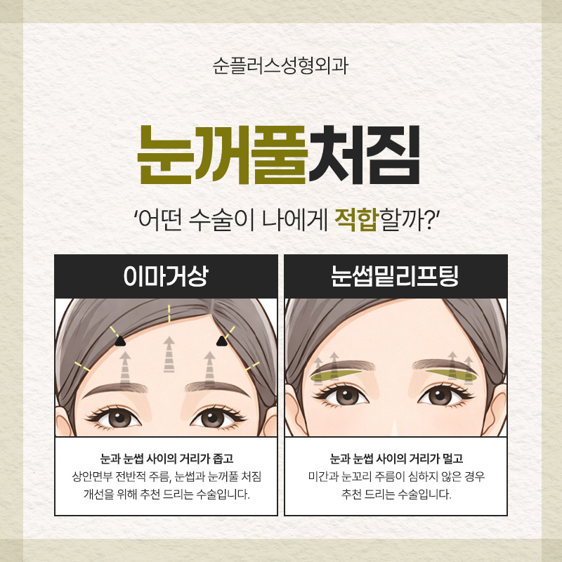 처진 눈꺼풀, 눈썹밑 리프팅 통해 자연스럽게 올려줘 눈매를 또렷하게 관련 이미지 6