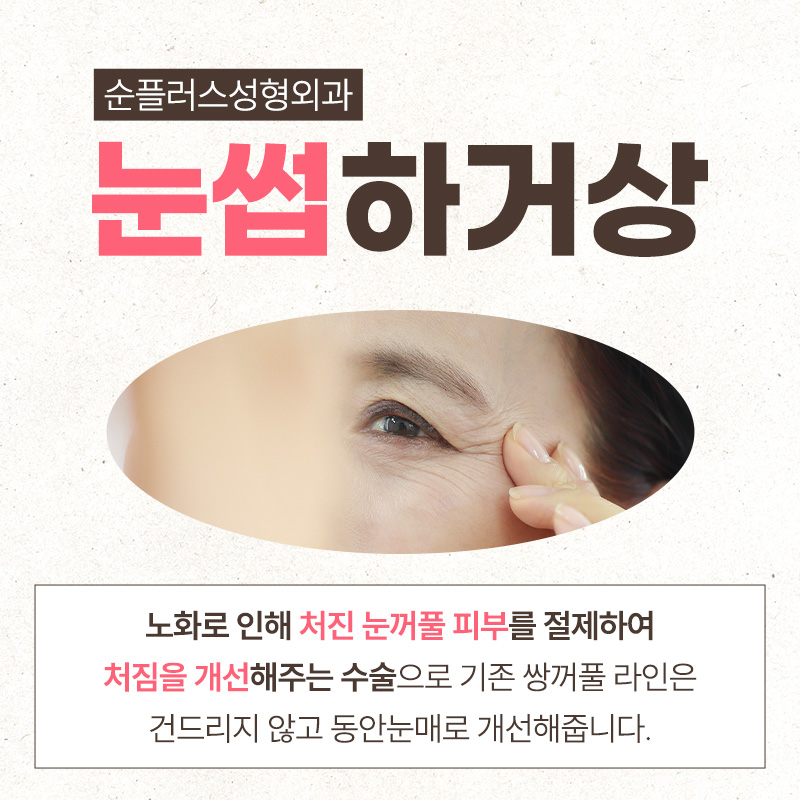 처지는 눈꺼풀 중년눈수술 눈썹하거상 관련 이미지 2