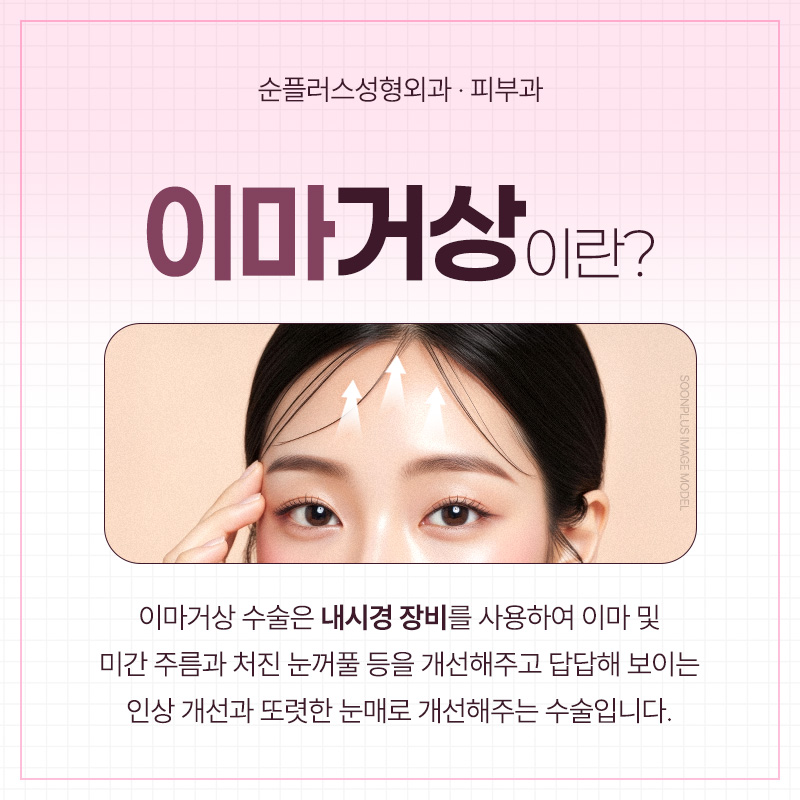 처진 눈매, 자연스럽게 시원해지는 방법 - 이마거상술 관련 이미지 2