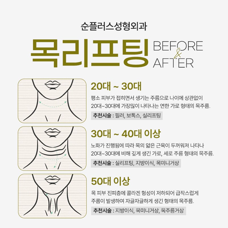Neck Lift Depending on Horizontal and Vertical Neck Wrinkles image 3