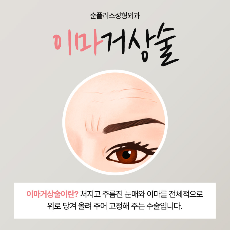 The Right Place for Forehead Lift Surgery After Checking the Symptoms image 2