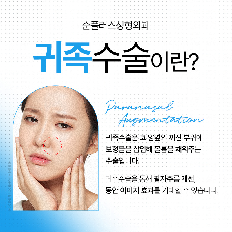 중안면 꺼짐&팔자주름 고민, 귀족수술로 해결하는 방법 관련 이미지 2