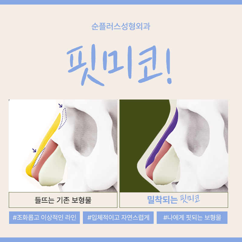 개별 맞춤보형물로 완성도를 높여주는 핏미코 관련 이미지 3