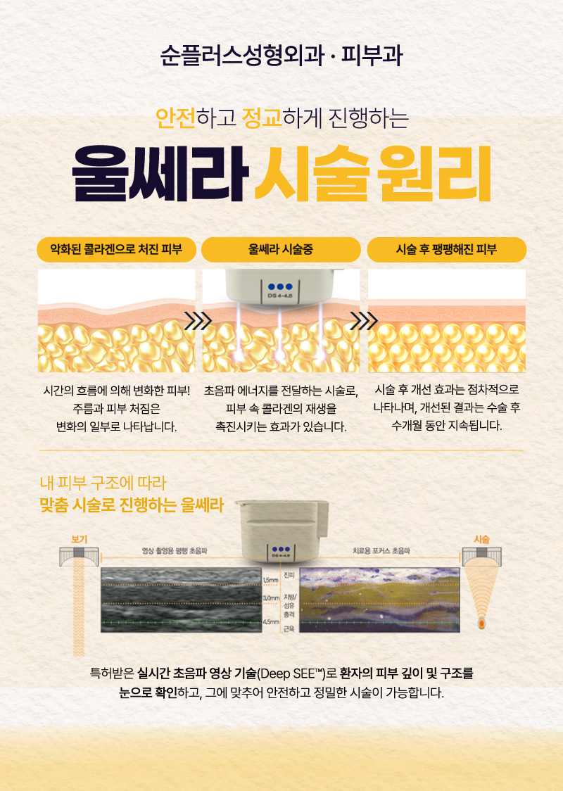 신사역 피부과 써마지 울쎄라 리프팅 부터 색소 잡티 기미 개선의 레이저까지 관련 이미지 3