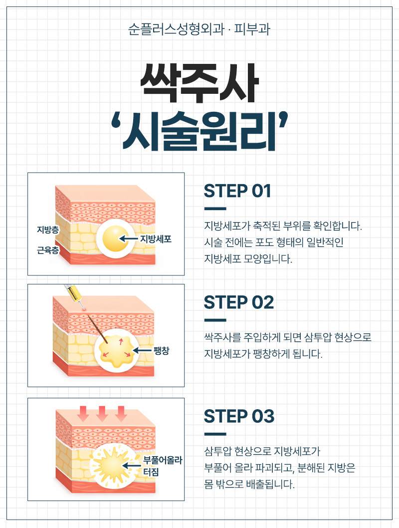 보기싫은 이중턱 허벅지 복부 팔뚝 지방을 싹-! 지방파괴주사, 싹주사 관련 이미지 4