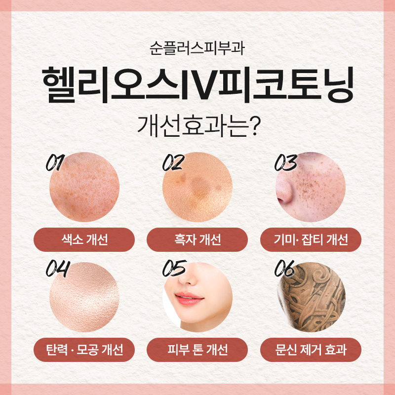 Brighten the Skin with Improved Melanin Pigmentation Deep in the Skin for Dark Spots, Melasma, Pigmentation, and Blemishes - Helios IV Pico Toning image 4