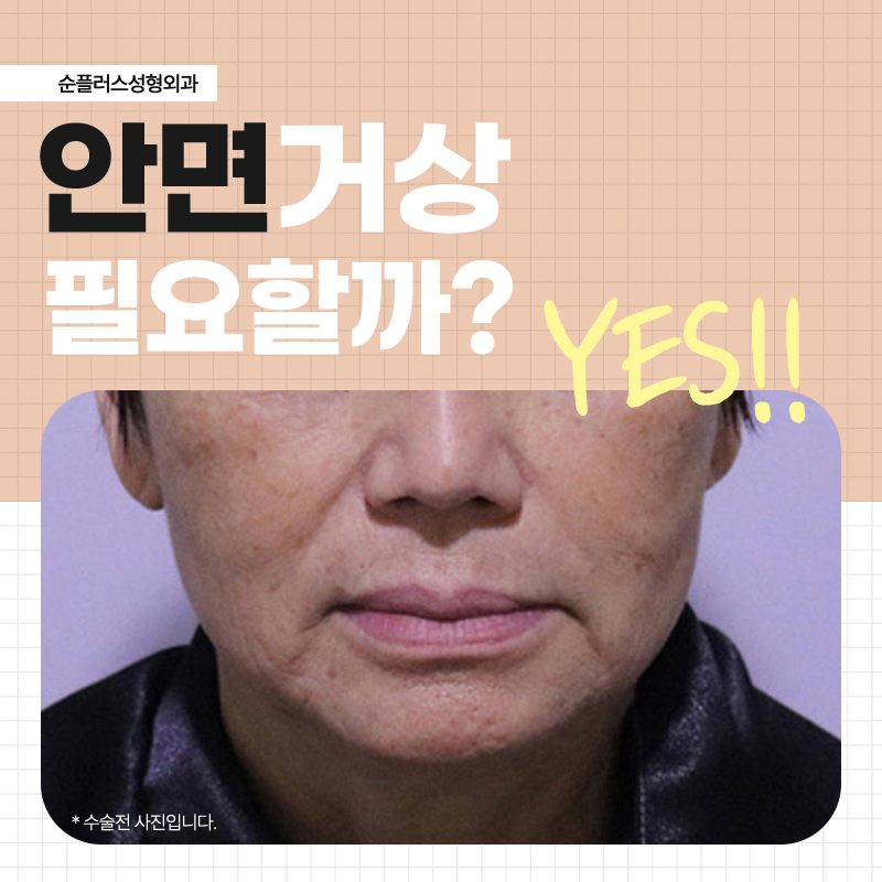 If You’re Having Difficulty Choosing a Facelift Hospital image 2