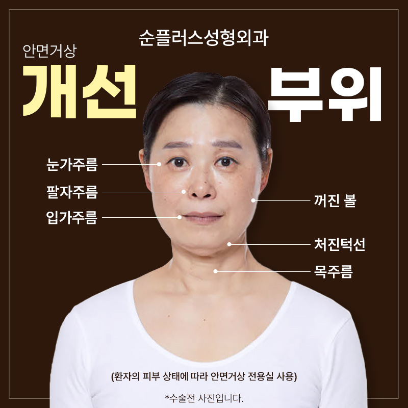 Specialized Facial Lift Clinic _ As skin ages, it needs to be lifted from within to help improve sagging image 4