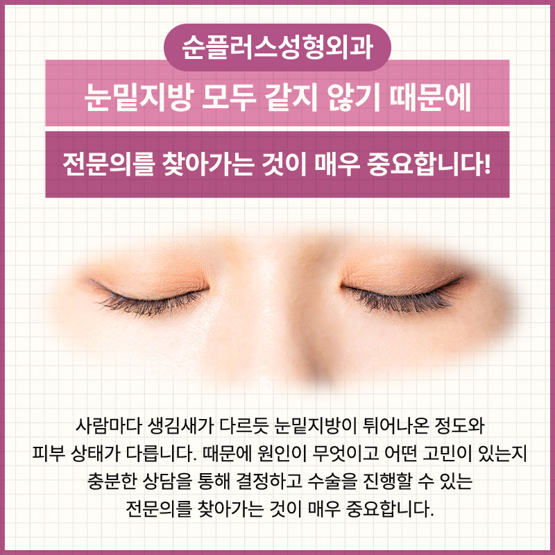 눈밑지방수술 꺼짐과 돌출이 동반되었을때 관련 이미지 6