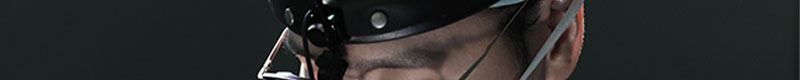 Brow Lift Surgery to Raise Sagging Eyelids and Improve the Eye Shape image 16