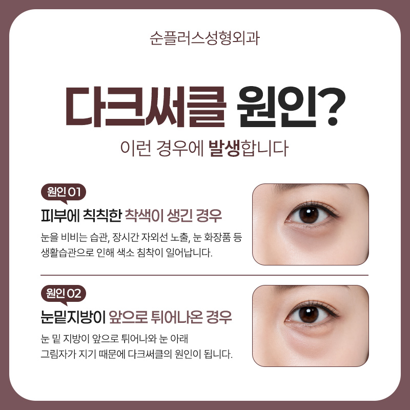 Why Under-Eye Fat Develops and Why Under-Eye Fat Repositioning May Be Needed image 3