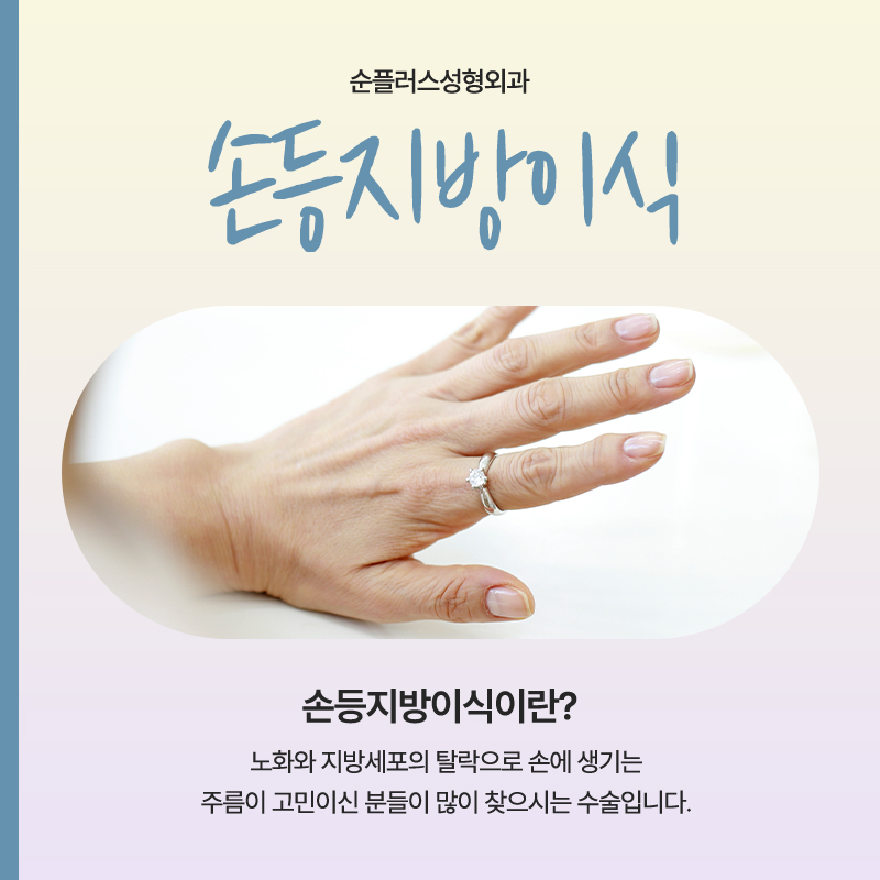 Hand Back Fat Grafting: The Traces of Time in Your Hands image 2