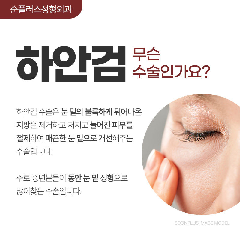 50대 60대 눈밑지방성형은 지방과 피부처짐 동시개선이 필요할수도 [하안검] 관련 이미지 2
