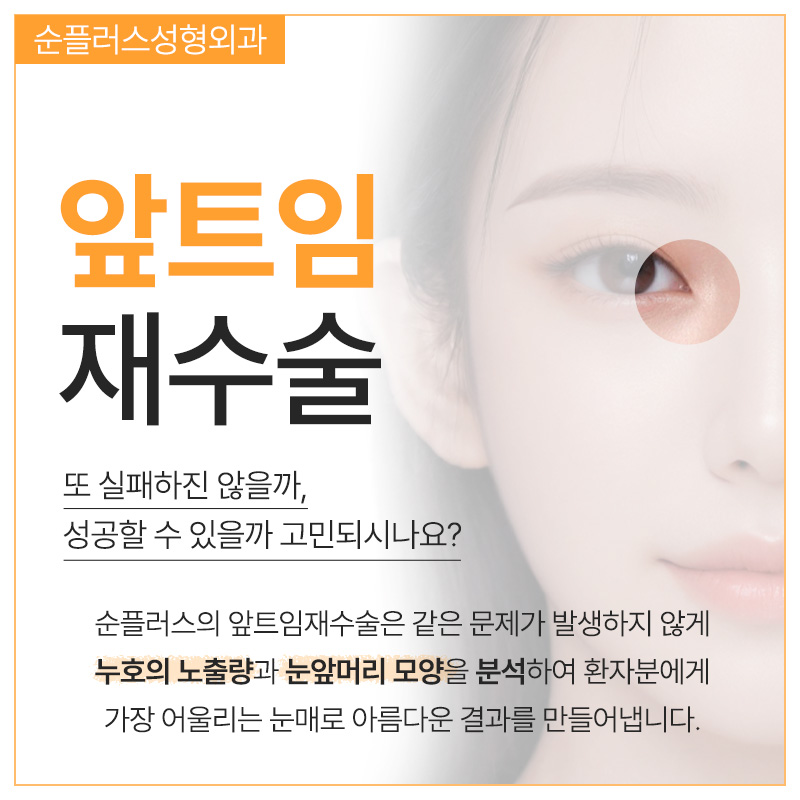앞트임재수술 복원으로 눈앞머리 자연스럽게 관련 이미지 2