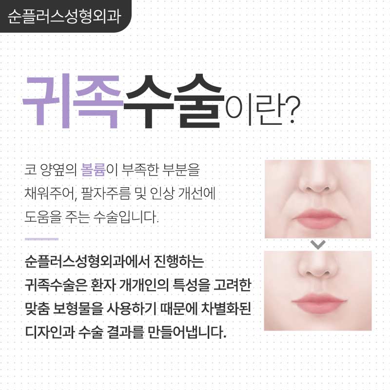 팔자주름 돌출입 개선에 보형물 넣는 귀족수술로 효과본다면? 관련 이미지 2