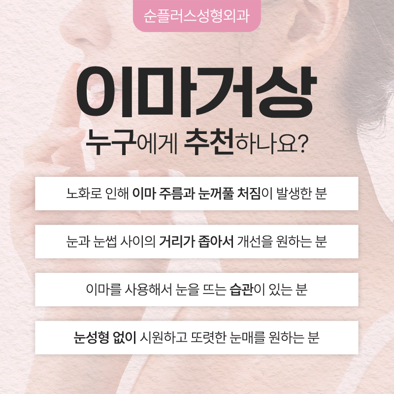 카리나 눈매 처럼 부담스럽지 않은 시원한 눈매효과를? 이마거상 관련 이미지 3
