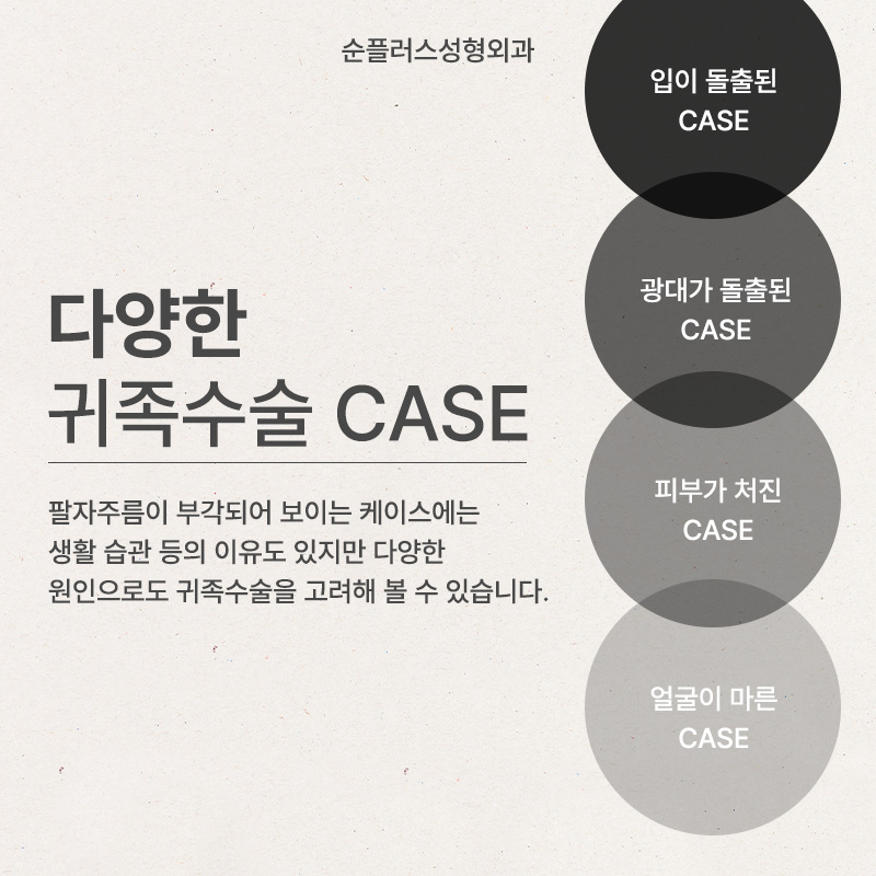 팔자주름보형물 개인별 맞춤 제작이 된다고? 관련 이미지 3