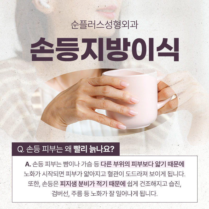 울퉁불퉁했던 손등 손지방이식 후 매끄럽게 관련 이미지 3