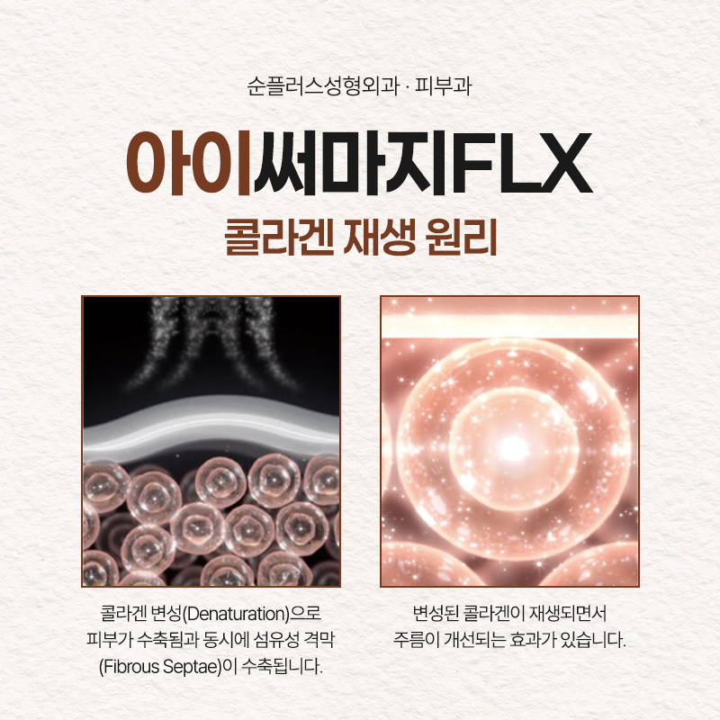 Eye Thermage: How to Restore Elasticity Around the Eyes? From Effects to How Long It Lasts image 4