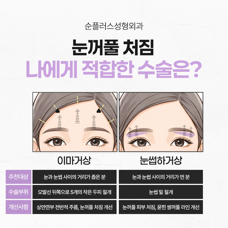 50대 60대 눈썹하거상, 자연스러운 동안 인상의 핵심은 따로 있다. 관련 이미지 3