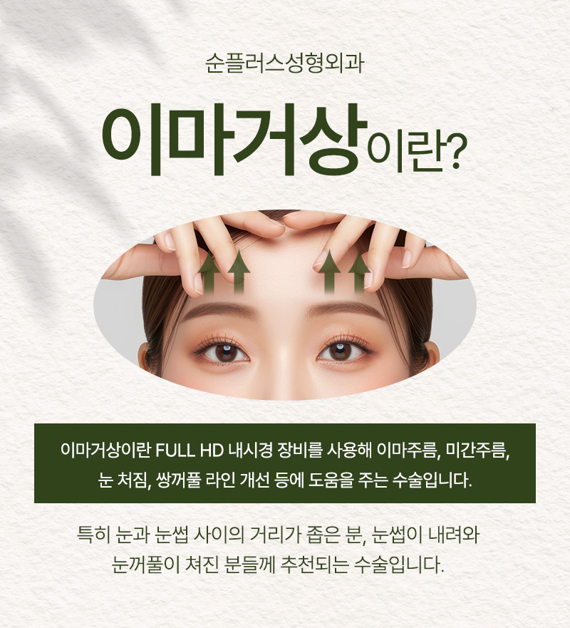Endoscopic Forehead Lift Surgery: Simultaneously Improving Drooping Eyebrows and Forehead Wrinkles image 2