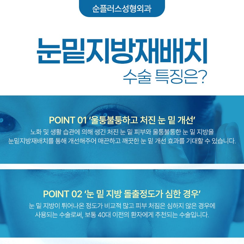눈밑지방재배치수술 회복은 빠르게 재발은 없도록 관련 이미지 5