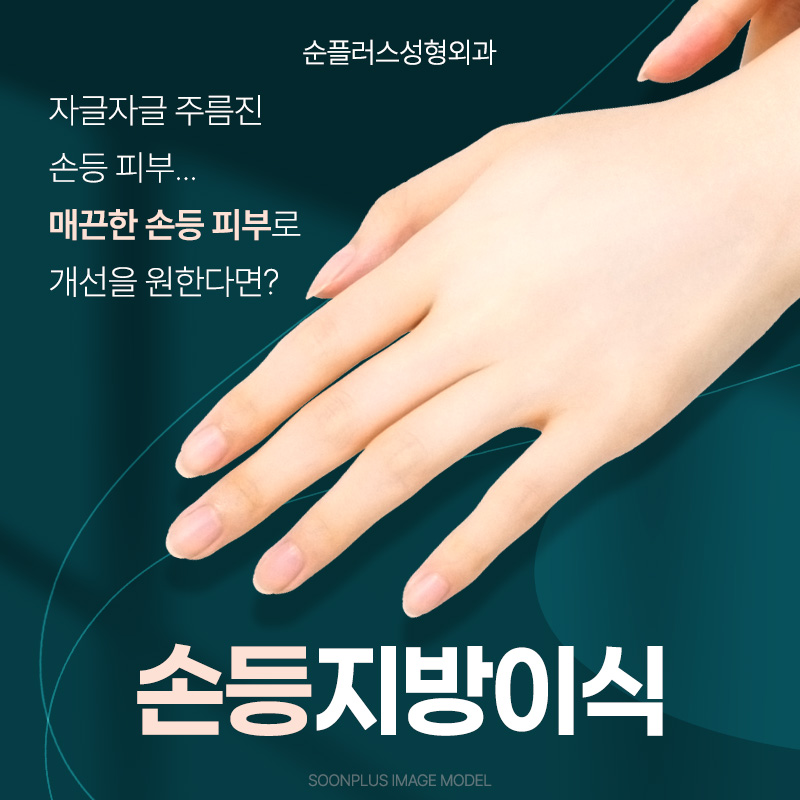울퉁불퉁 자글자글한 손등 주름, 힘줄, 혈관에 자연스러운 볼륨으로[손등지방이식] 관련 이미지 1