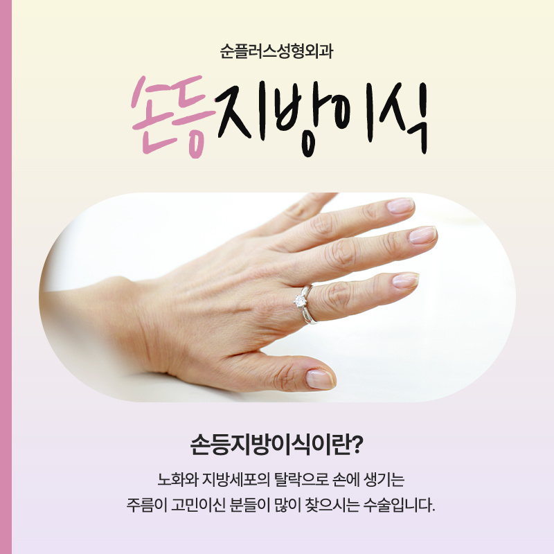 A lively effect for dry, wrinkled backs of the hands with fat grafting image 2