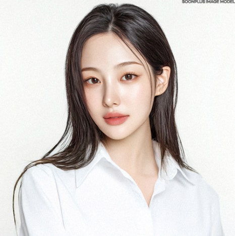 처진 눈꼬리로 우울해보이던 눈매 자연스러운 리프팅으로, 폭스아이리프팅 (눈꼬리 실리프팅) 관련 이미지 5