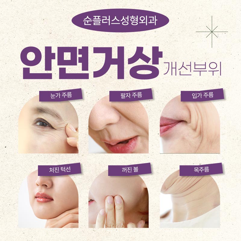Facelift Effect: When Skin Elasticity Improves image 3