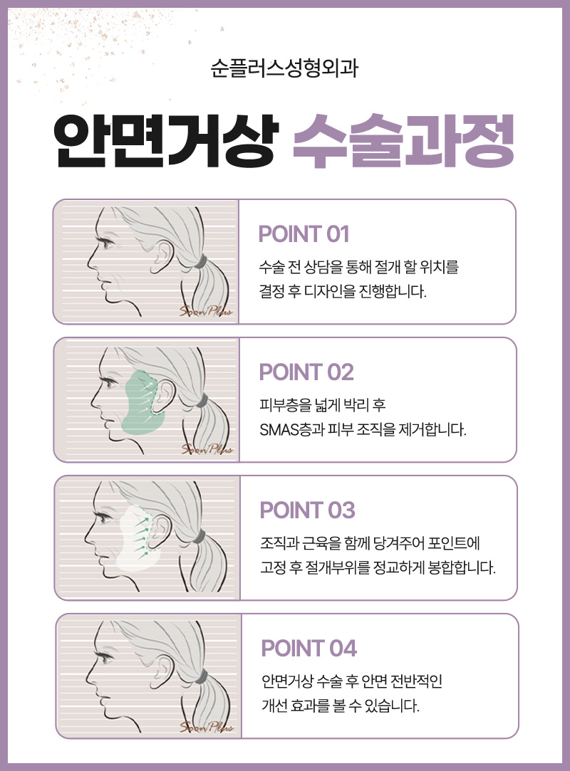 Will the Effects of a Facelift Last a Long Time? image 6
