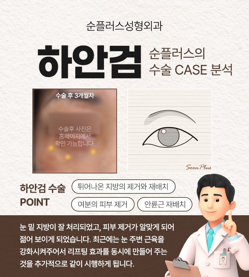 눈밑 하안검수술 회복기간 흉터도 찾아봐야 관련 이미지 4