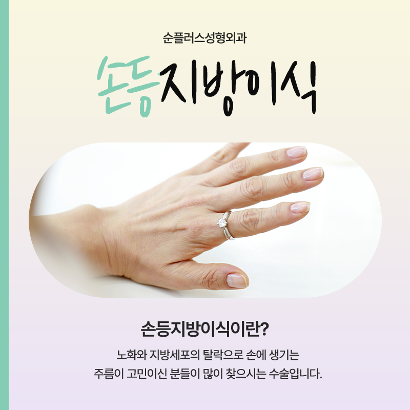 동안의 포인트는 손에서 나온다? [손등지방이식] 관련 이미지 2