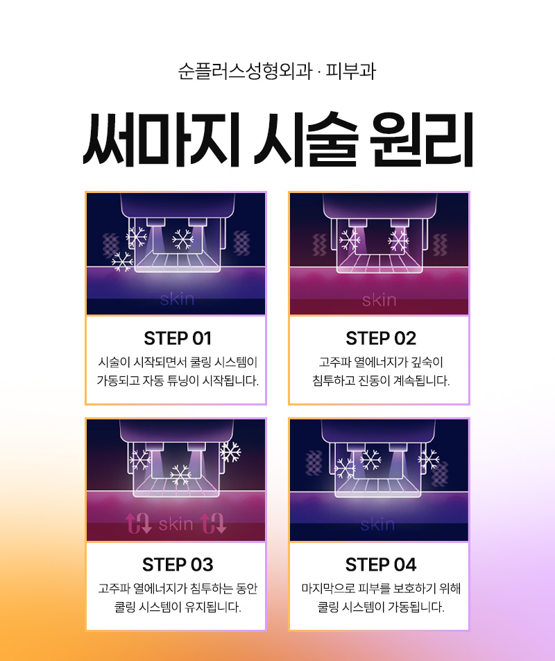 초음파와 고주파 리프팅의 시너지 효과, 울써마지란 관련 이미지 5