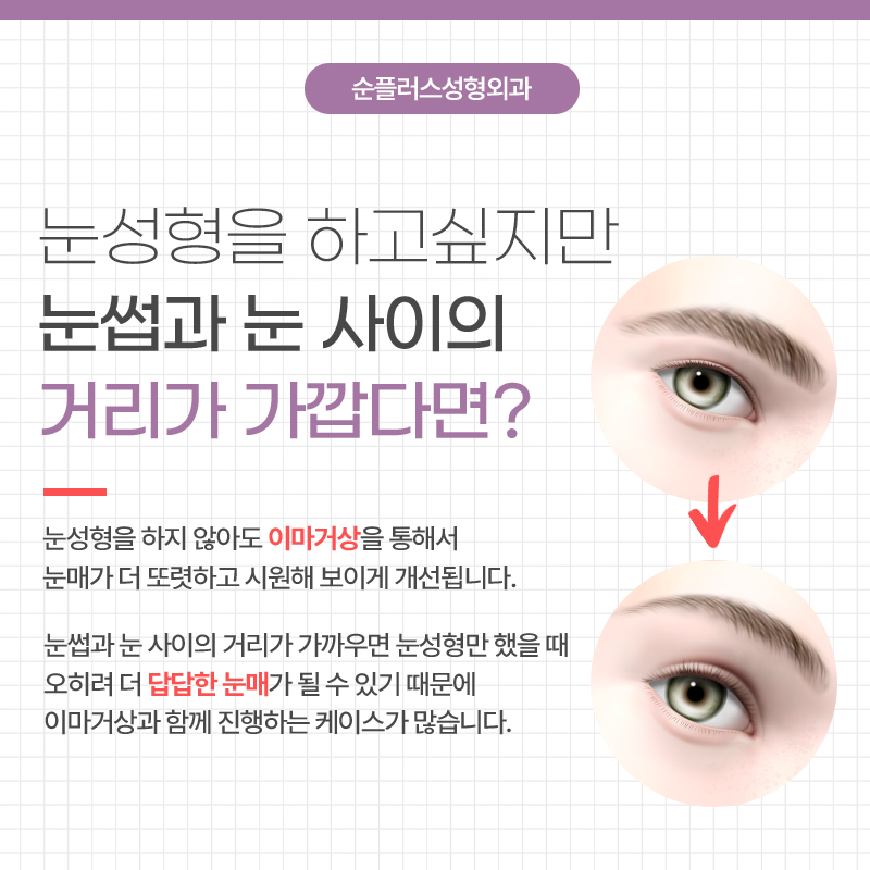 내시경이마거상 추천케이스가 따로 있나요 관련 이미지 3