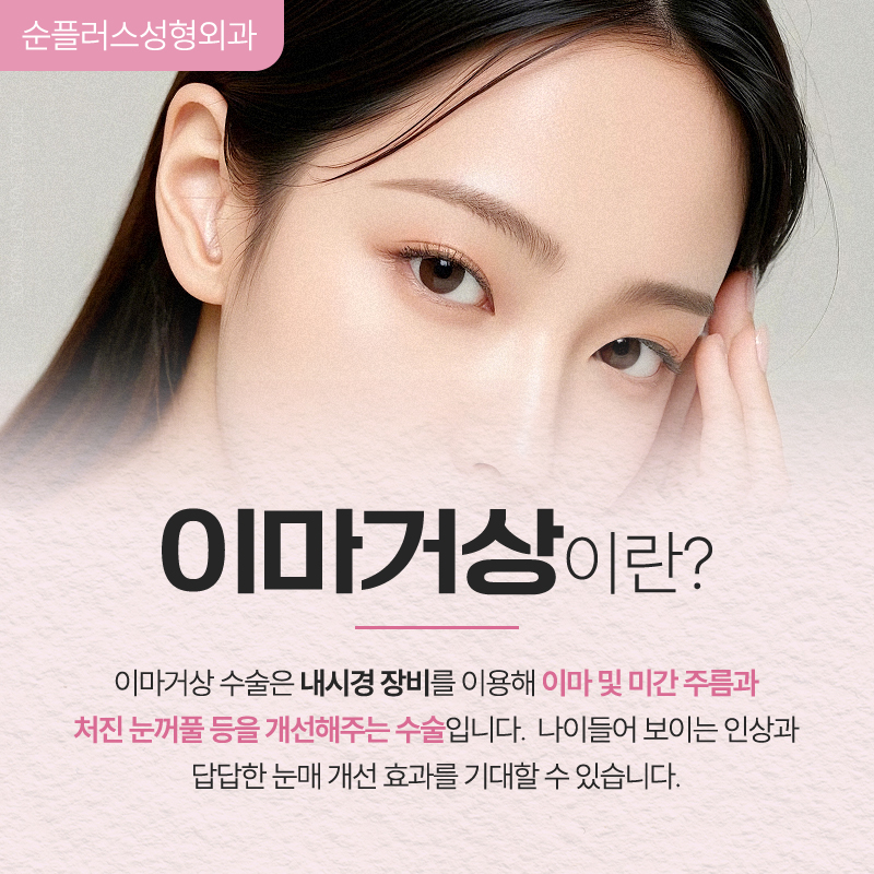 카리나 눈매 처럼 부담스럽지 않은 시원한 눈매효과를? 이마거상 관련 이미지 2