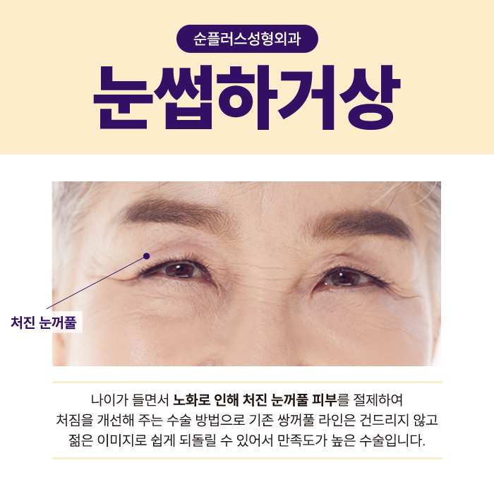 눈꺼풀처짐수술, 눈썹하거상 케이스로는 관련 이미지 2