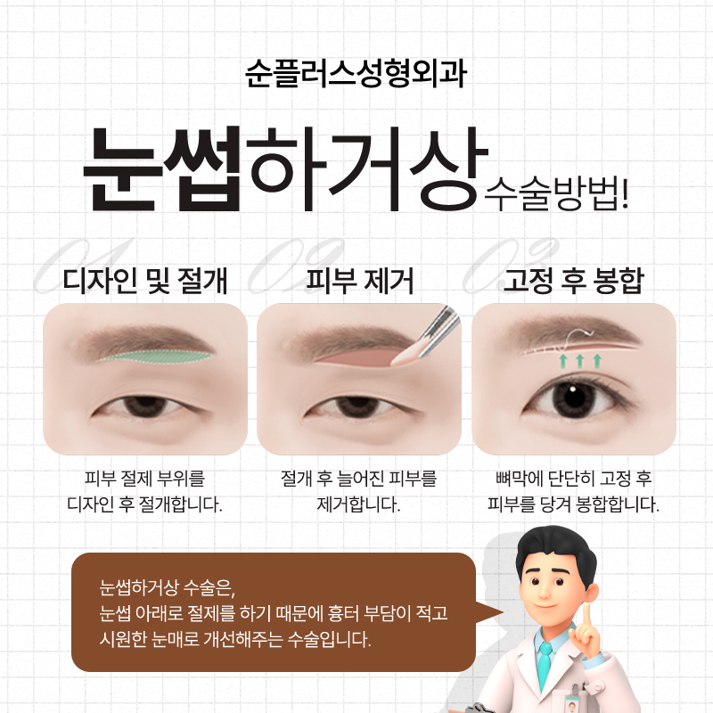 Making Parents’ Drooping Eyelids Look Clearer with the Effect of a Sub-Brow Lift image 3