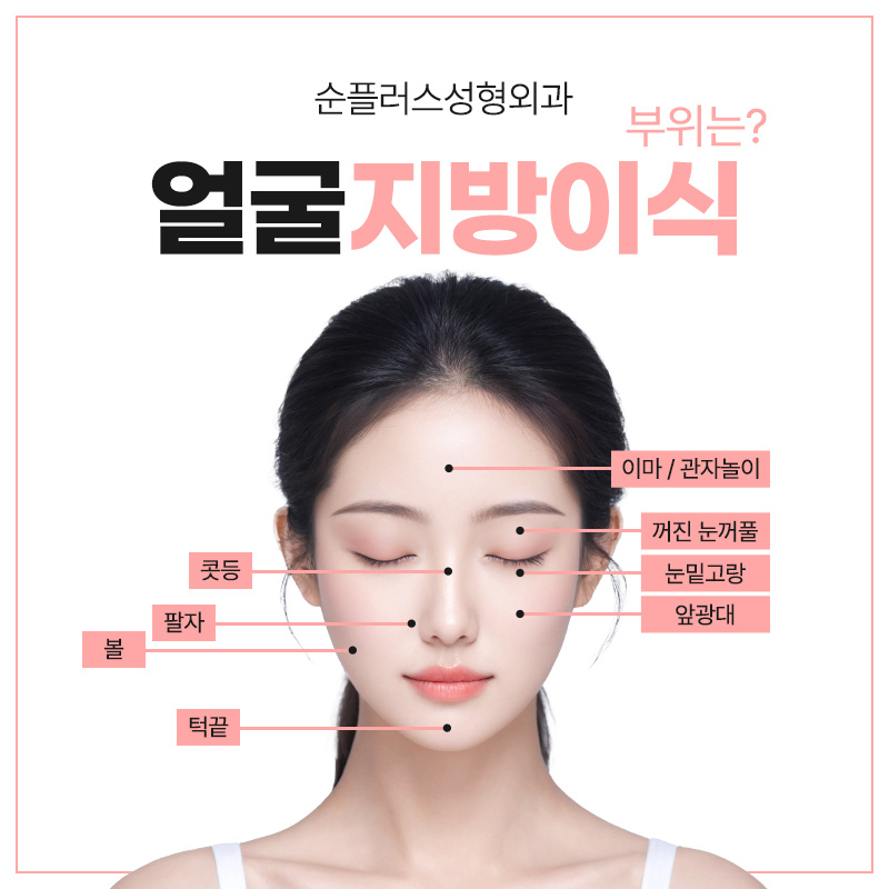 얼굴지방이식잘하는곳 볼륨이 필요한 곳에 관련 이미지 5