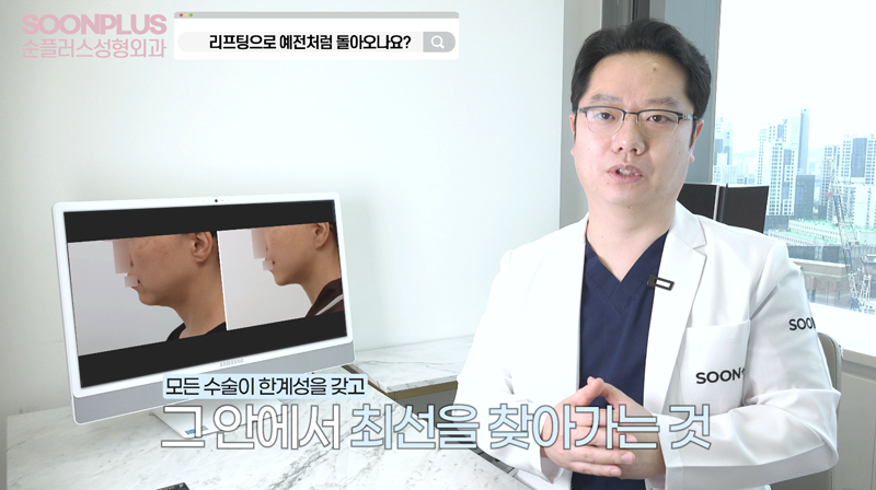 안면거상 지방이식 병행시의 안면거상효과 관련 이미지 4