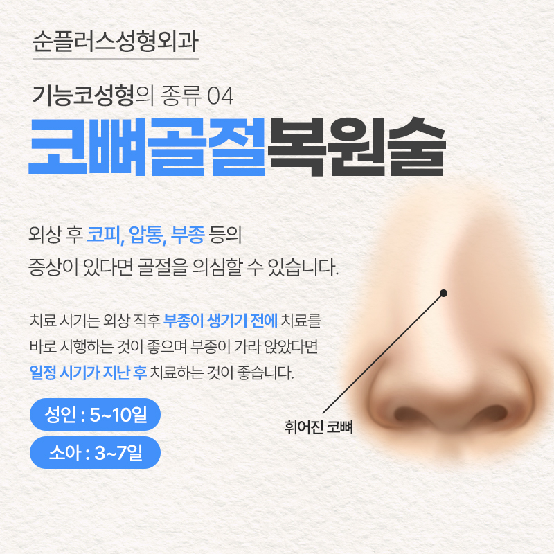 기능코수술 미용적 개선과 비염 비중격만곡증 개선으로 편안한 숨길 관련 이미지 6