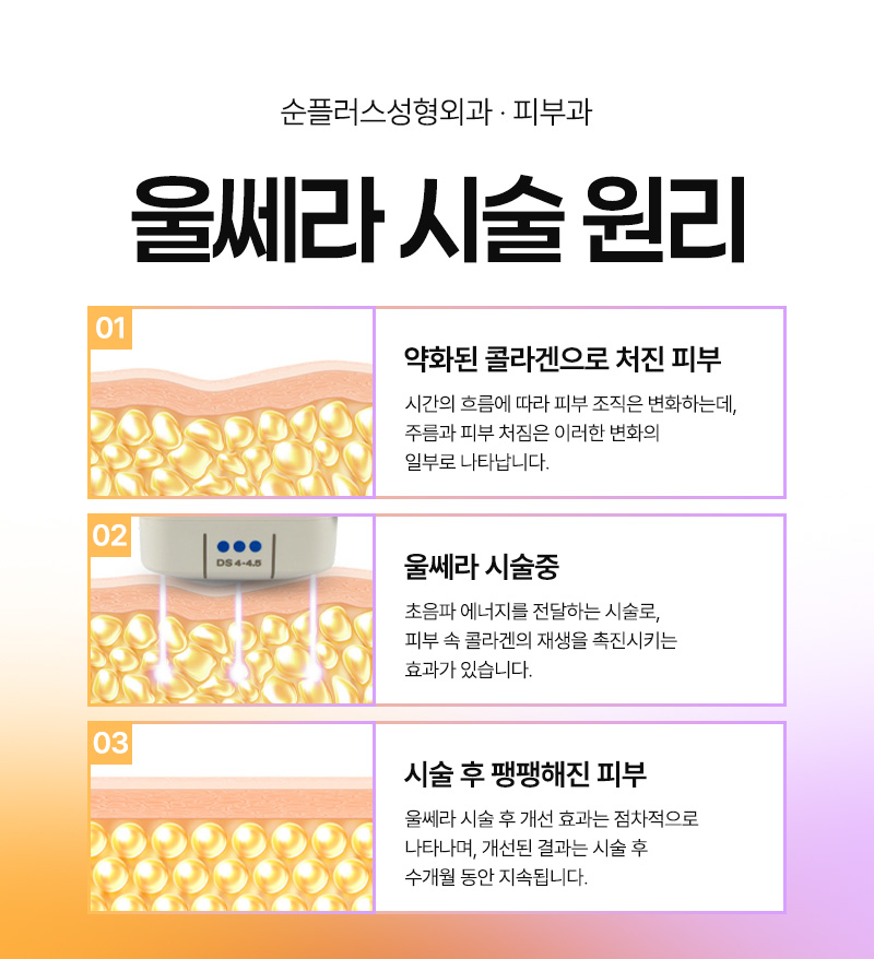 초음파와 고주파 리프팅의 시너지 효과, 울써마지란 관련 이미지 4