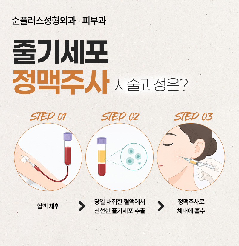 줄기세포 정맥주사, 세포 재생을 통한 효능/효과와 주의사항까지 관련 이미지 5