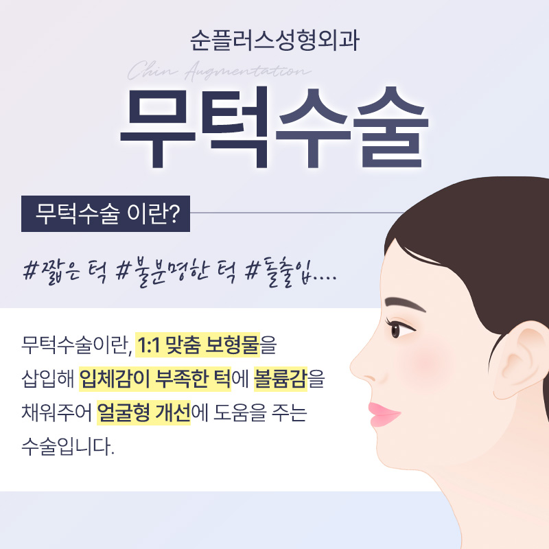무턱수술 하악에 볼륨을 주어 관련 이미지 2
