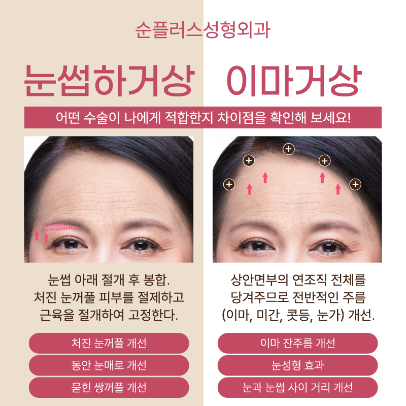 눈썹하거상 흉터 노출 줄이면서 눈은 또렷하게 관련 이미지 5